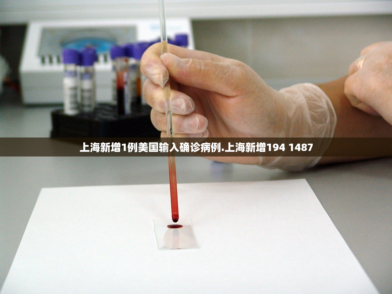 上海新增1例美国输入确诊病例.上海新增194 1487 上海新增1例美国输入确诊病例.上海新增194 1487