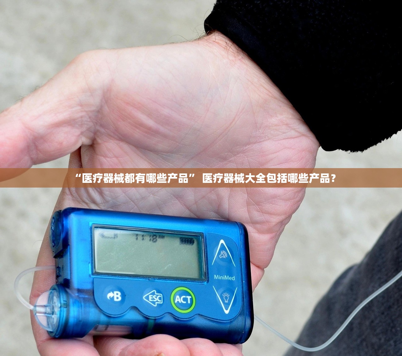 “医疗器械都有哪些产品	” 医疗器械大全包括哪些产品？