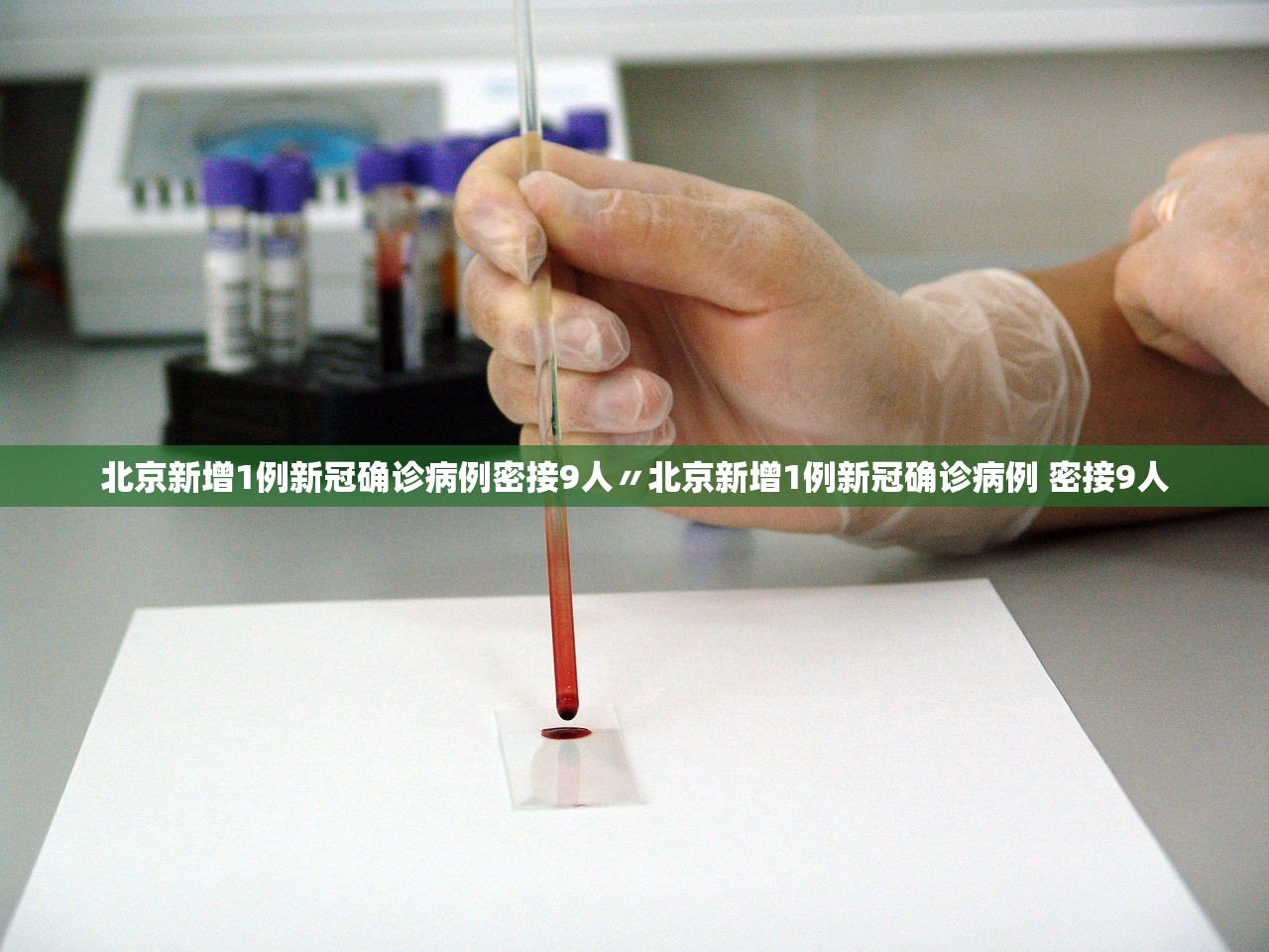 北京新增1例新冠确诊病例密接9人〃北京新增1例新冠确诊病例 密接9人